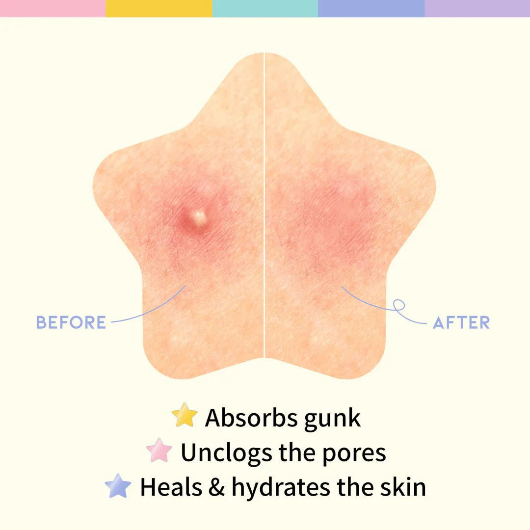 OOTD BEAUTY  Star Spot Patch 80 patches