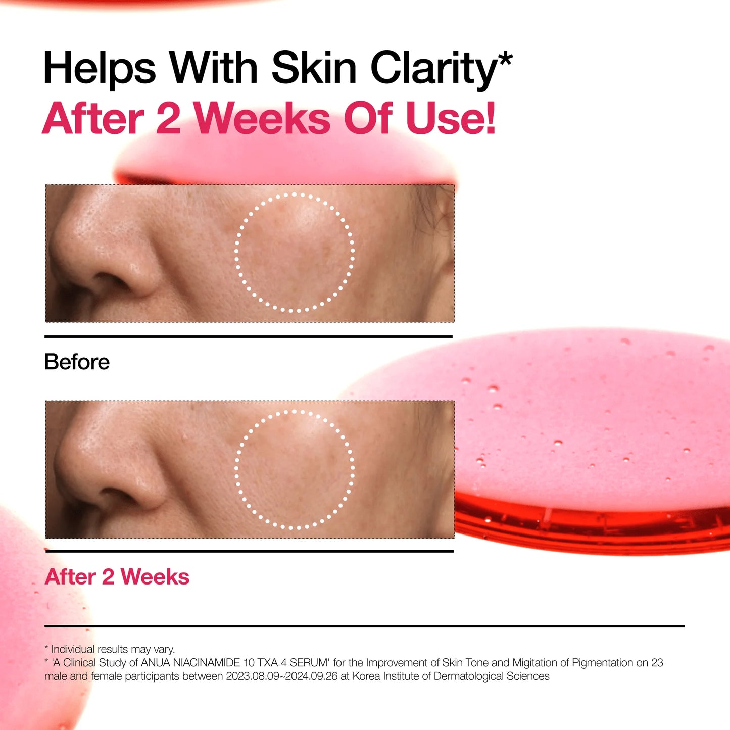 ANUA] [RENEW] NIACINAMIDE10% + TXA 4% SERUM 30mL