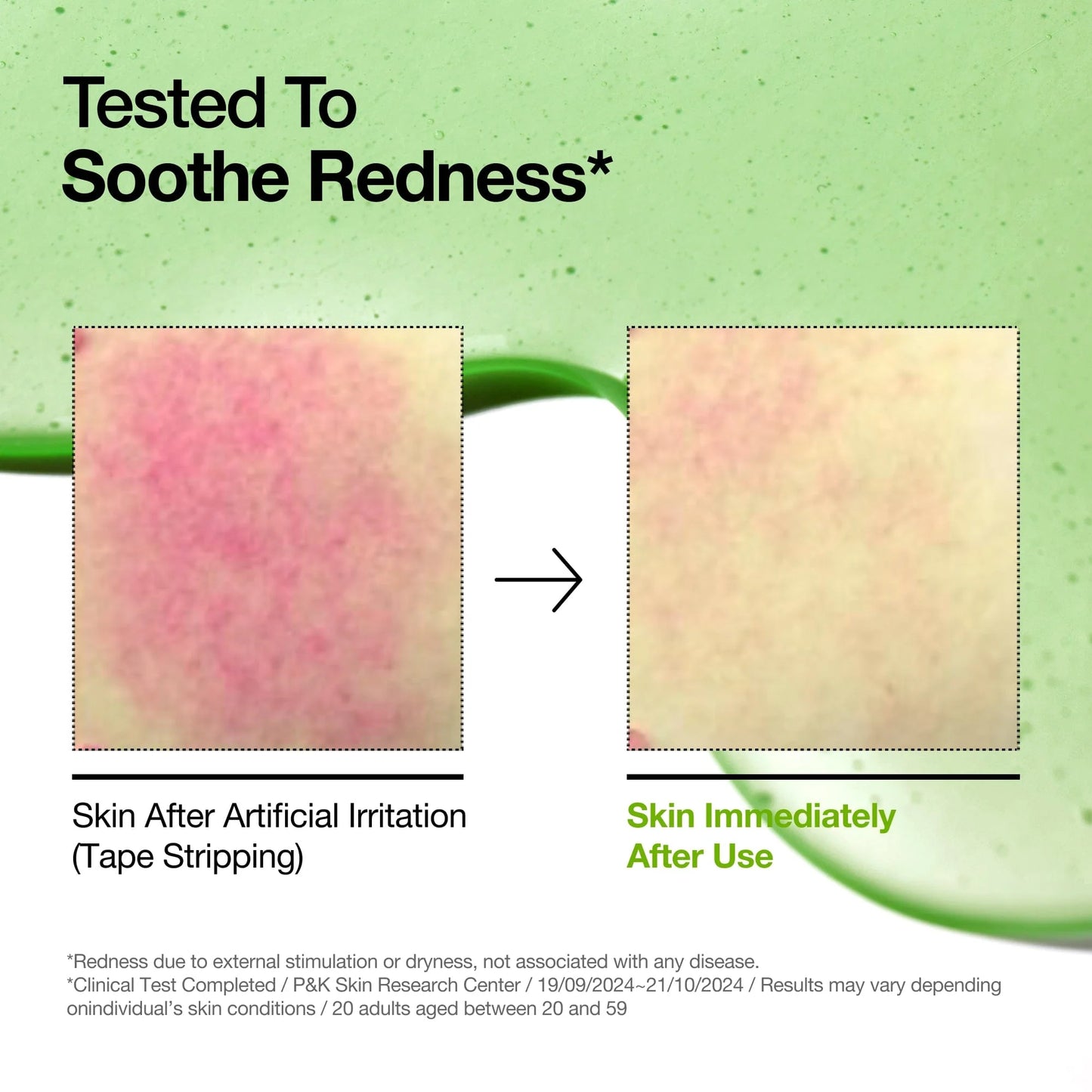 ANUA] Azelaic Acid 10 Hyaluron Redness Soothing Serum 30ml